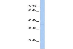 SULT1C2 antibody used at 1 ug/ml to detect target protein. (SULT1C2 抗体  (C-Term))