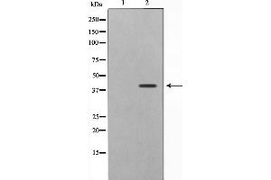 Western blot analysis on 293 cell lysate using CBX6 Antibody,The lane on the left is treated with the antigen-specific peptide. (CBX6 抗体  (N-Term))