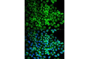 Immunofluorescence analysis of U2OS cells using GRIA3 antibody. (Glutamate Receptor 3 抗体)