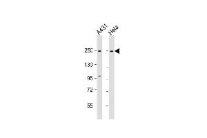 All lanes : Anti-MYH9 Antibody (N-term ) at 1:1000 dilution Lane 1: A431 whole cell lysate Lane 2: Hela whole cell lysate Lysates/proteins at 20 μg per lane. (Myosin 9 抗体  (N-Term))