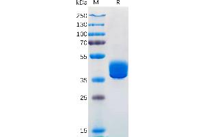 Human ADA Protein, hFc Tag on SDS-PAGE under reducing condition.