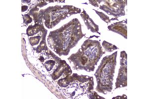 Immunohistochemistry (IHC) image for anti-Major Vault Protein (MVP) (AA 2-259) antibody (ABIN5692897)