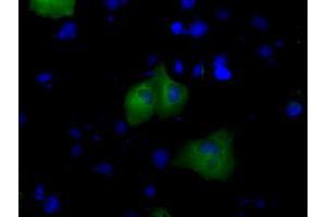 Anti-BTK mouse monoclonal antibody (ABIN2452830) immunofluorescent staining of COS7 cells transiently transfected by pCMV6-ENTRY BTK (RC211582). (BTK 抗体)