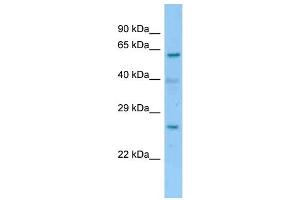 WB Suggested Anti-2700060E02Rik Antibody   Titration: 1. (RIKEN CDNA 2700060E02 Gene (2700060E02RIK) (C-Term) 抗体)