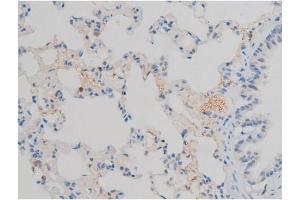 Immunohistochemistry (IHC) image for anti-Activating Transcription Factor 2 (ATF2) (pThr53), (pThr71) antibody (ABIN6255706)