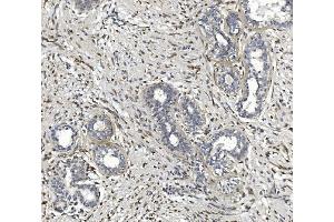 IHC analysis of CTHRC1 using anti-CTHRC1 antibody (ABIN7601256).