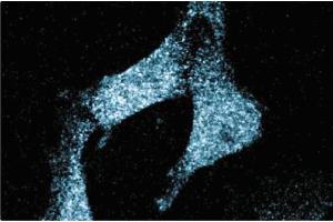 Immunofluorescence staining of human endothelial cells. (SCARB1 抗体  (AA 104-294))