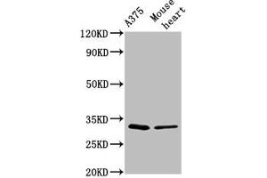 Western Blot Positive WB detected in: A375 whole cell lysate, Mouse heart tissue All lanes: TIMMDC1 antibody at 2. (TIMMDC1 抗体  (AA 444-585))