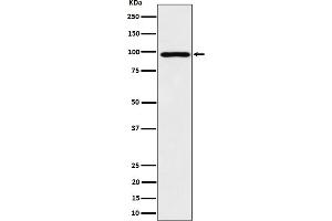 Western blot analysis of AKAP 95 expression in HepG2 cell lysate.