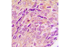 Immunohistochemistry (IHC) image for anti-Cytochrome P450, Family 2, Subfamily U, Polypeptide 1 (CYP2U1) (Center) antibody (ABIN7298496)