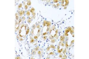 Immunohistochemistry of paraffin-embedded human stomach using TDGF1 antibody (ABIN3021341, ABIN3021342, ABIN3021343 and ABIN6214922) at dilution of 1:100 (40x lens). (TDGF1 抗体  (AA 1-188))