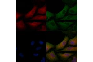 ABIN6258287 and ABIN6275230 staining  cells by IF/ICC. (MGST2 抗体  (Internal Region))