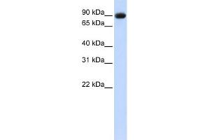 WB Suggested Anti-POSTN Antibody  Titration: 1 ug/ml Positive Control: 293T cells lysate (Periostin 抗体  (Middle Region))