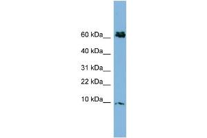 WB Suggested Anti-CRIP1  Antibody Titration: 0. (CRIP1 抗体  (N-Term))