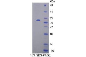 SDS-PAGE analysis of Human HMG20B Protein. (HMG20B 蛋白)