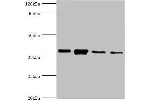 Western blot All lanes: Anxa1 antibody at 2 μg/mL Lane 1: PC-3 whole cell lysate Lane 2: A431 whole cell lysate Lane 3: K562 whole cell lysate Lane 4: MCF-7 whole cell lysate Secondary Goat polyclonal to rabbit IgG at 1/10000 dilution Predicted band size: 39 kDa Observed band size: 39 kDa (Annexin a1 抗体  (AA 2-346))