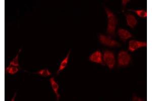 ABIN6275236 staining HeLa by IF/ICC. (MRPS27 抗体  (N-Term))