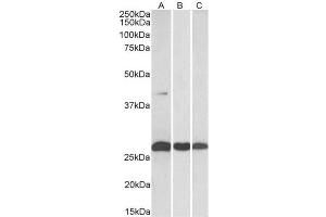 AP32149PU-N (0. (DUSP6 抗体  (C-Term))