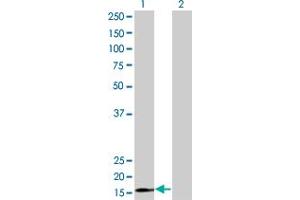 Western Blot analysis of RPS15 expression in transfected 293T cell line by RPS15 monoclonal antibody (M01), clone 4H8. (RPS15 抗体  (AA 77-145))