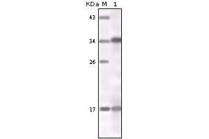Western blot analysis using IFN-gamma mouse mAb against IFN-gamma recombinant protein.