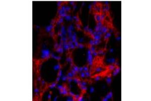 Immunohistochemistry (IHC) image for anti-Collagen, Type I, alpha 1 (COL1A1) (C-Term) antibody (ABIN6657341)