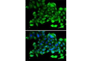 Immunofluorescence analysis of A-549 cells using CLIC4 antibody (ABIN6127638, ABIN6138723, ABIN6138724 and ABIN6222890).