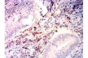 Immunohistochemical analysis of paraffin-embedded rectum cancer tissues using CD14 mouse mAb with DAB staining. (CD14 抗体  (AA 230-345))