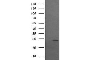 Image no. 2 for anti-Sex Determining Region Y (SRY) antibody (ABIN1501139) (SRY 抗体)