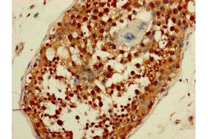 Immunohistochemistry (IHC) image for anti-Apoptosis Antagonizing Transcription Factor (AATF) (AA 6-294) antibody (ABIN7165006)