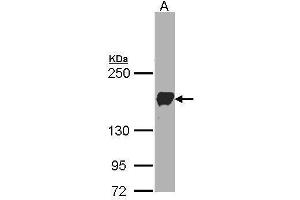 WB Image Sample(30 ug whole cell lysate) A:A431, 5% SDS PAGE antibody diluted at 1:1000 (Protocadherin 1 抗体)