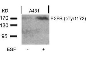 Image no. 2 for anti-Epidermal Growth Factor Receptor (EGFR) (pTyr1172) antibody (ABIN196960) (EGFR 抗体  (pTyr1172))