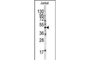Western blot analysis of HFE antibody in Jurkat cell line lysates (35ug/lane) (HFE 抗体  (AA 122-148))
