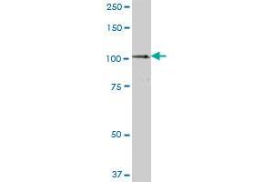 Western Blotting (WB) image for anti-Signal Transducer and Activator of Transcription 6, Interleukin-4 Induced (STAT6) (AA 1-847) antibody (ABIN520550)