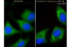 Immunofluorescent analysis of 4 % paraformaldehyde-fixed, 0. (GABARAP 抗体  (AA 1-30))
