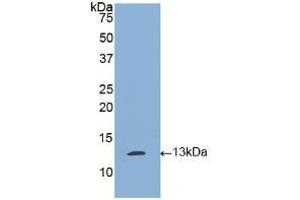 Western blot analysis of recombinant Human tPA. (PLAT 抗体  (AA 36-126))