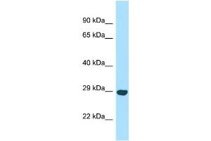 WB Suggested Anti-OFCC1 Antibody Titration: 1.