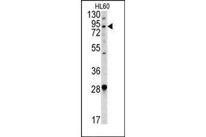 Image no. 1 for anti-Angiotensin I Converting Enzyme 2 (ACE2) (Center) antibody (ABIN358576) (ACE2 抗体  (Center))