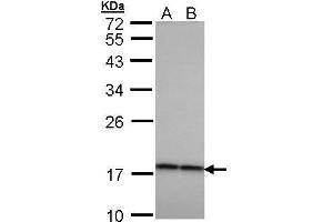 WB Image Sample (30 ug of whole cell lysate) A: H1299 B: HeLa 12% SDS PAGE antibody diluted at 1:1000 (CRYbA4 抗体)