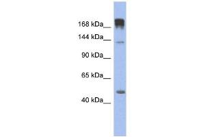 SLIT3 antibody used at 1 ug/ml to detect target protein. (SLIT3 抗体)