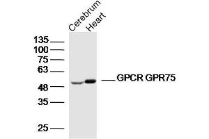 Lane 1: Mouse cerebrum lysates Lane 2: mouse heart lysates probed with GPCR GPR75 Polyclonal Antibody, Unconjugated  at 1:300 dilution and 4˚C overnight incubation.