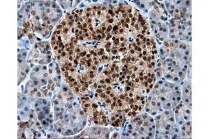 Immunohistochemical staining of paraffin-embedded liver tissue using anti-RALBP1 mouse monoclonal antibody. (RALBP1 抗体)