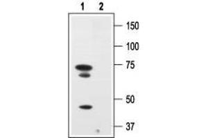 Western blot analysis of human melanoma cells A875: - 1.