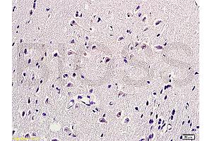 Formalin-fixed and paraffin embedded rat brain labeled with  (ABIN672441)  Rabbit Anti-HSP27 HspB1 HSP25 Polyclonal Antibody, unconjugated 1: 200 followed by incubation with conjugated secondary antibody and DAB staining. (HSP27 抗体  (AA 101-205))