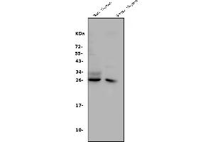 Western blot analysis of CD8 alpha/Cd8a using anti-CD8 alpha/Cd8a antibody (ABIN7601570). (CD8 alpha 抗体  (AA 39-245))