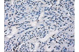 Immunohistochemical staining of paraffin-embedded Ovary tissue using anti-CYP2E1 mouse monoclonal antibody. (CYP2E1 抗体)