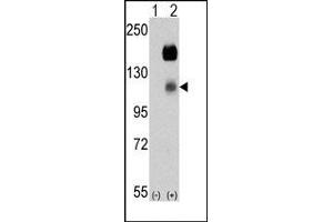 Image no. 1 for anti-PTK7 Protein tyrosine Kinase 7 (PTK7) (N-Term) antibody (ABIN360111) (PTK7 抗体  (N-Term))