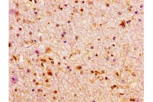 IHC image of ABIN7155649 diluted at 1:100 and staining in paraffin-embedded human brain tissue performed on a Leica BondTM system. (Arx 抗体  (AA 381-460))