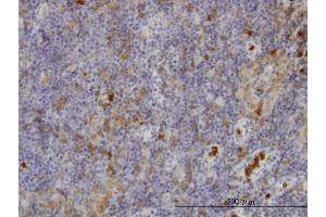 Immunoperoxidase of monoclonal antibody to FGR on formalin-fixed paraffin-embedded human lymph node. (Fgr 抗体  (AA 1-90))