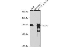 Immunoprecipitation analysis of 200 μg extracts of 293T cells, using 3 μg ROCK1 antibody . (ROCK1 抗体)