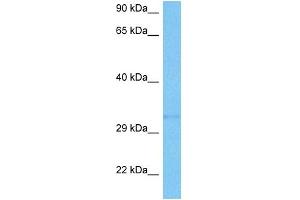 Host:  Mouse  Target Name:  SMN1  Sample Tissue:  Mouse Kidney  Antibody Dilution:  1ug/ml (SMN1 抗体  (N-Term))